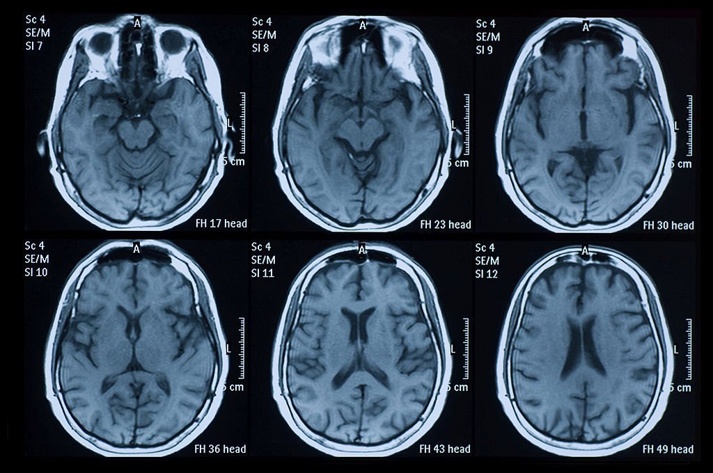 Medical AI image annotation